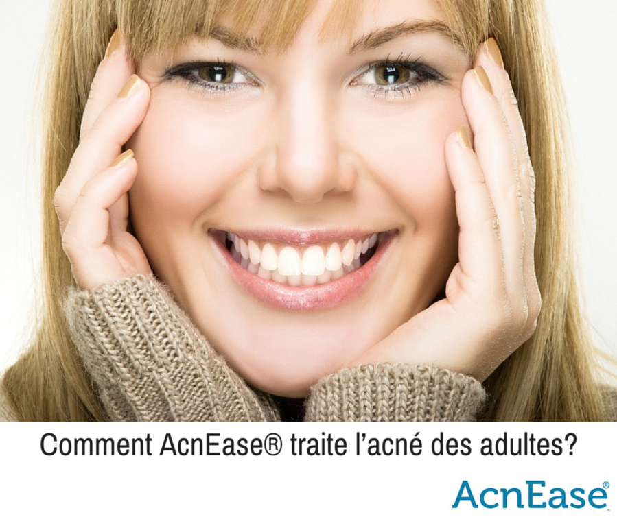 Comment AcnEase traite l’acné des adultes?