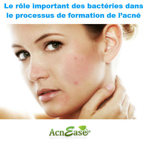 Pourquoi devez-vous connaître le rôle important des bactéries dans le processus de formation de l’acné?