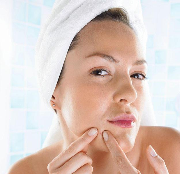 7 astuces qui auront un impact MAJEUR sur votre lutte contre l’acné