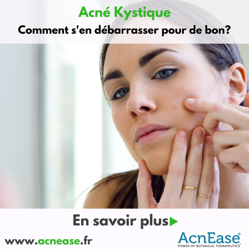 Comment se débarrasser de l’acné kystique pour de bon