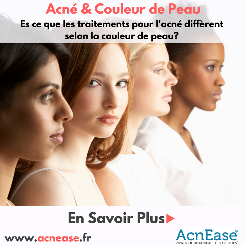 Es ce que les traitements pour l'acné diffèrent selon la couleur de peau?