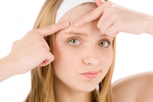 L’acné à l’adolescence : Comment en finir pendant l’été ?