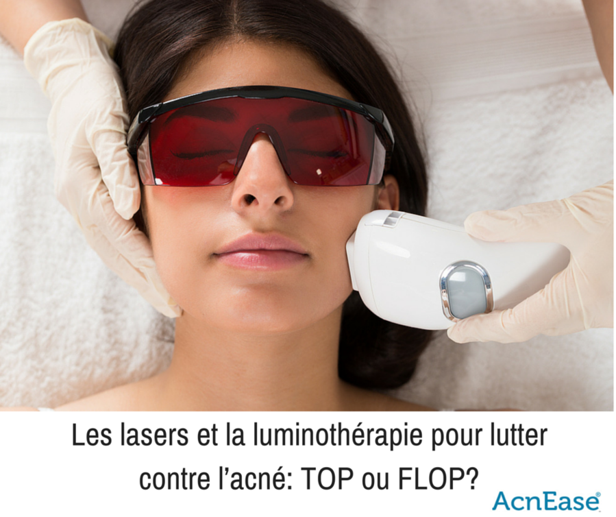 Les lasers et la luminothérapie pour lutter contre l’acné: TOP ou FLOP?