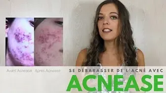 Débarrassé de l'ACNÉ SÉVÈRE !