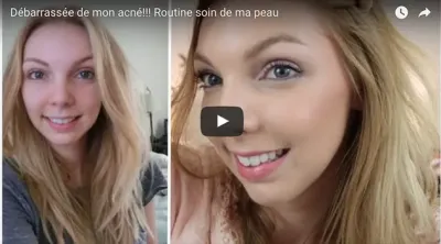 <cite><q>C'est vraiment ce qui a complétement change ma peau</q></cite> - Sandrea