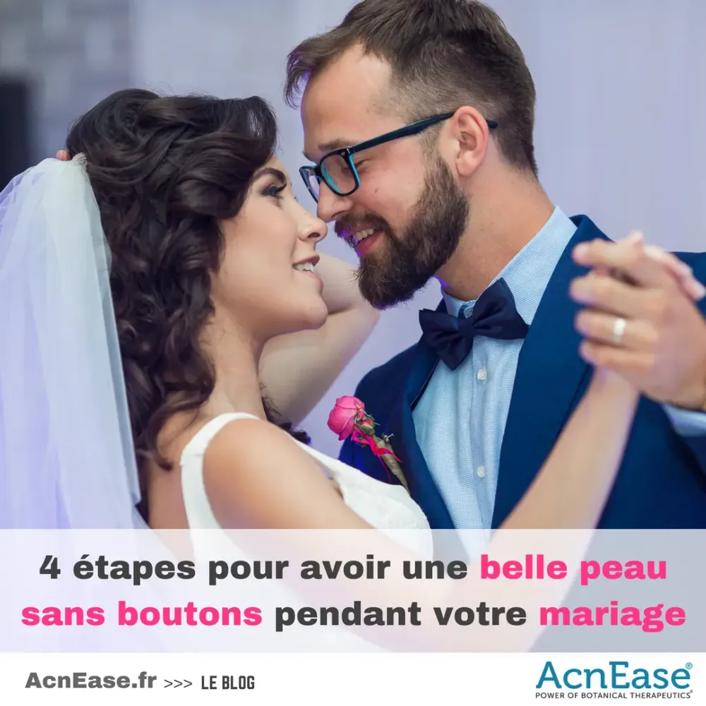 4 étapes pour avoir une belle peau sans boutons pendant votre mariage