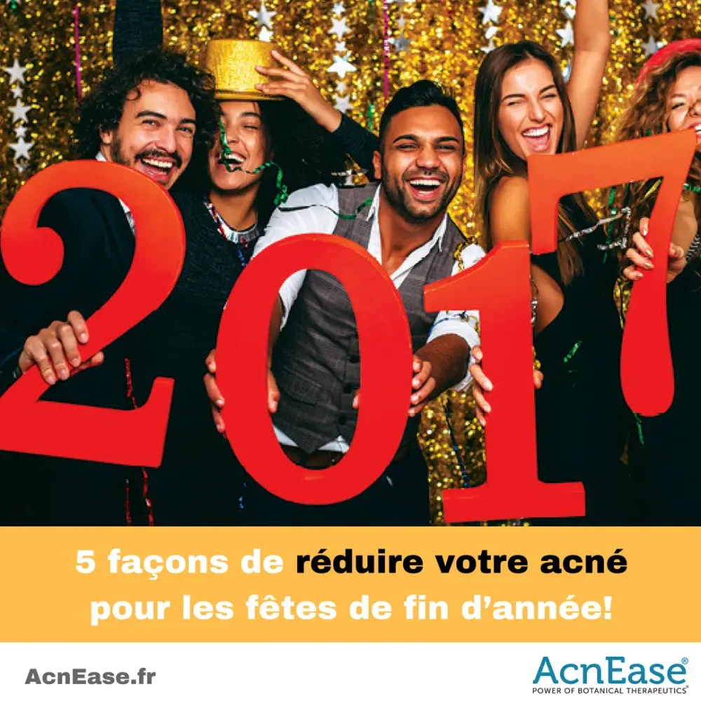 5 façons de réduire votre acné pour les fêtes de fin d’année!