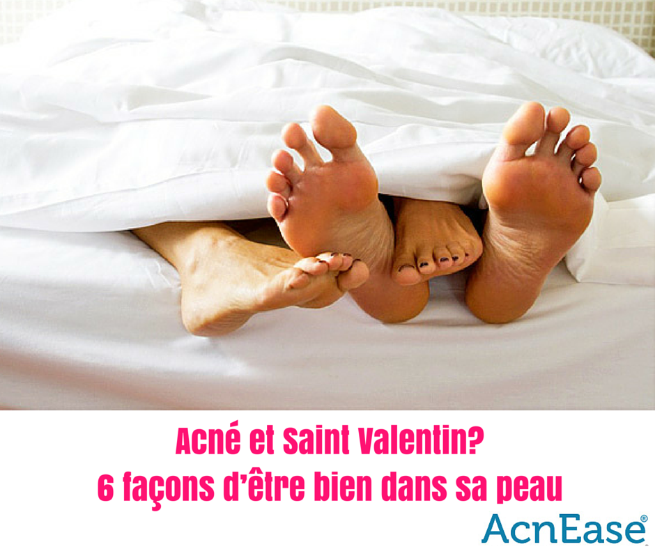 Acné et Saint Valentin? Voici 6 façons d’être bien dans sa peau