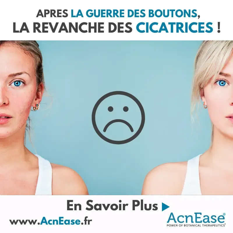 Après la guerre des boutons: la revanche sur les cicatrices!