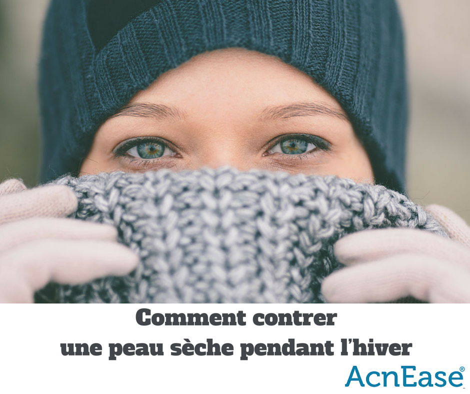 Comment contrer une peau sèche pendant l’hiver