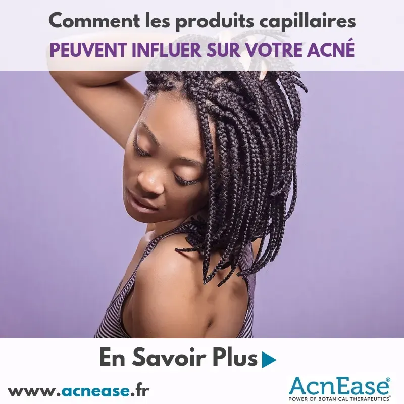 Comment les produits capillaires peuvent influer sur votre acné