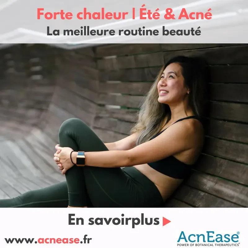 Forte chaleur | Eté: La meilleure routine beauté pour les peaux acnéique