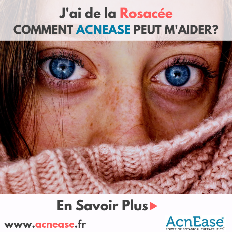 J'ai de la rosacée. Comment AcnEase peut-il aider?