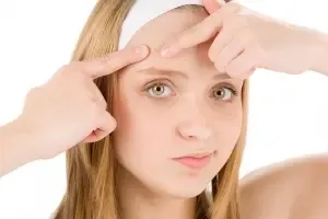 L’acné à l’adolescence : Comment en finir pendant l’été ?