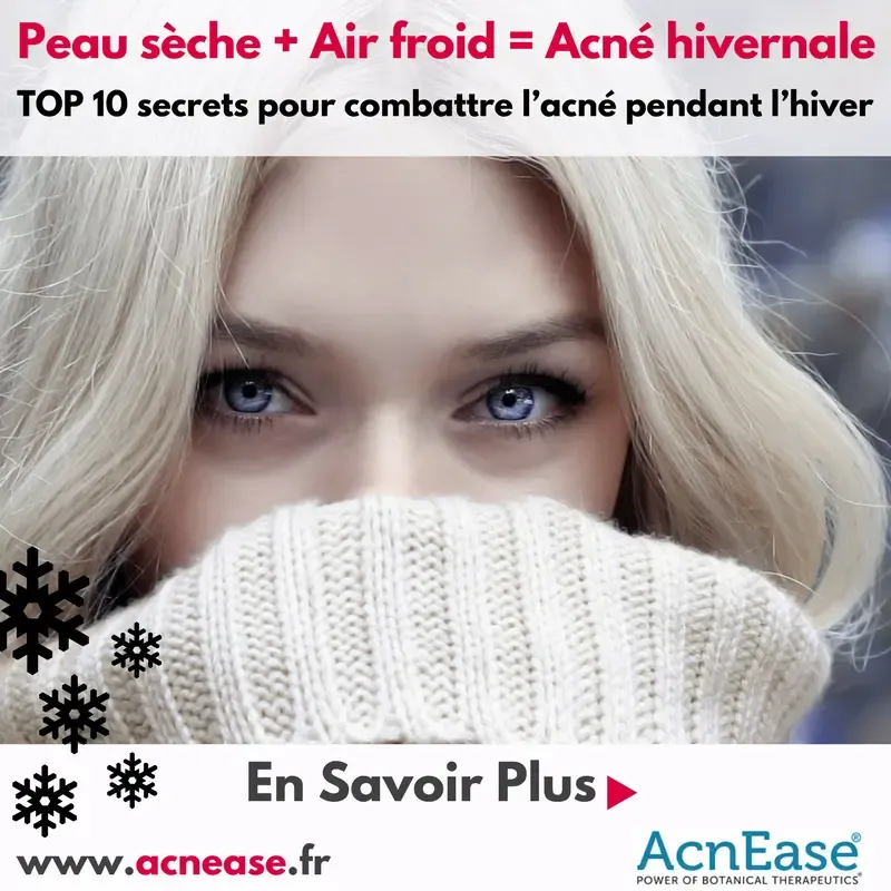 Peau sèche + Air froid = Acné hivernale