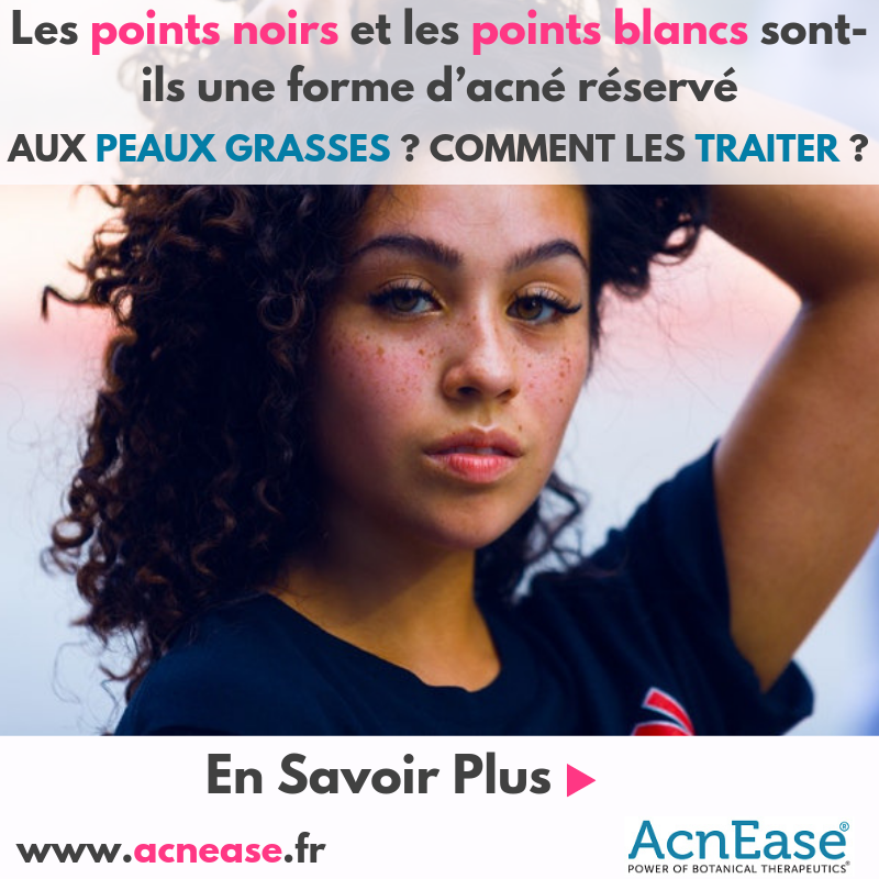 Les points noirs et les boutons blancs sont-ils une forme d’acné réservée aux peaux grasses? Comment les traiter?