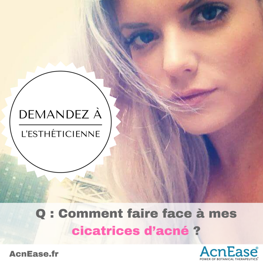 Q : Comment faire face à mes cicatrices d’acné ?