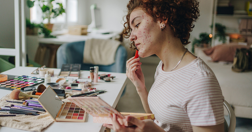 Conseils de maquillage d'été pour les peaux à tendance acnéique et tous types de peau