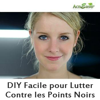 Un DIY facile pour lutter contre les points noirs