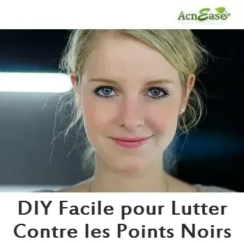 Un DIY facile pour lutter contre les points noirs
