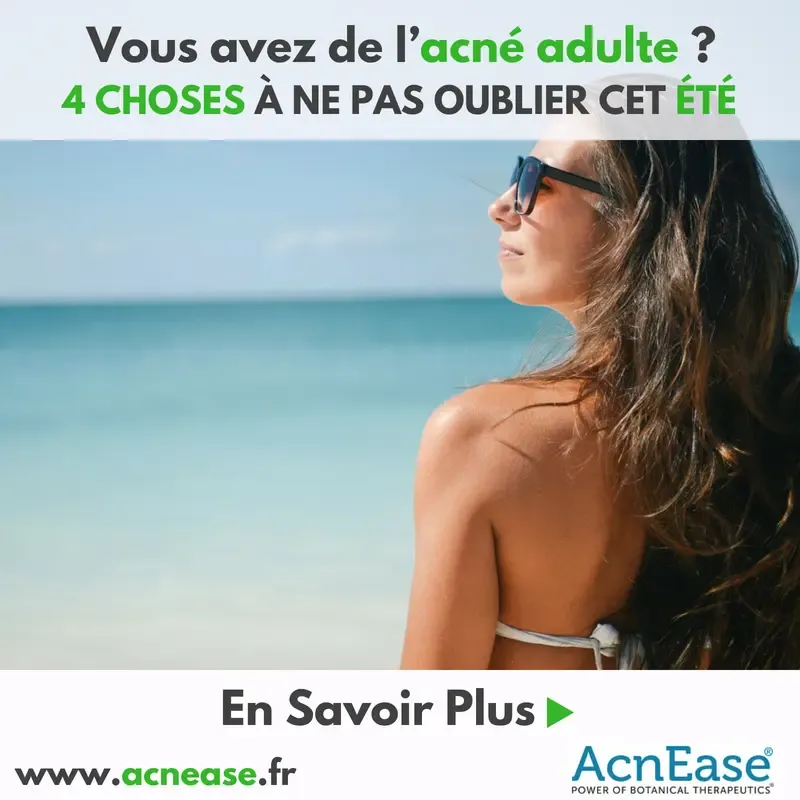 Vous avez de l’acné adulte? 4 CHOSES À NE PAS OUBLIER CET ÉTÉ
