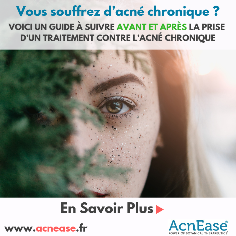 Vous souffrez d’acné chronique? Voici un guide à suivre avant et après la prise d’un traitement contre l’acné chronique